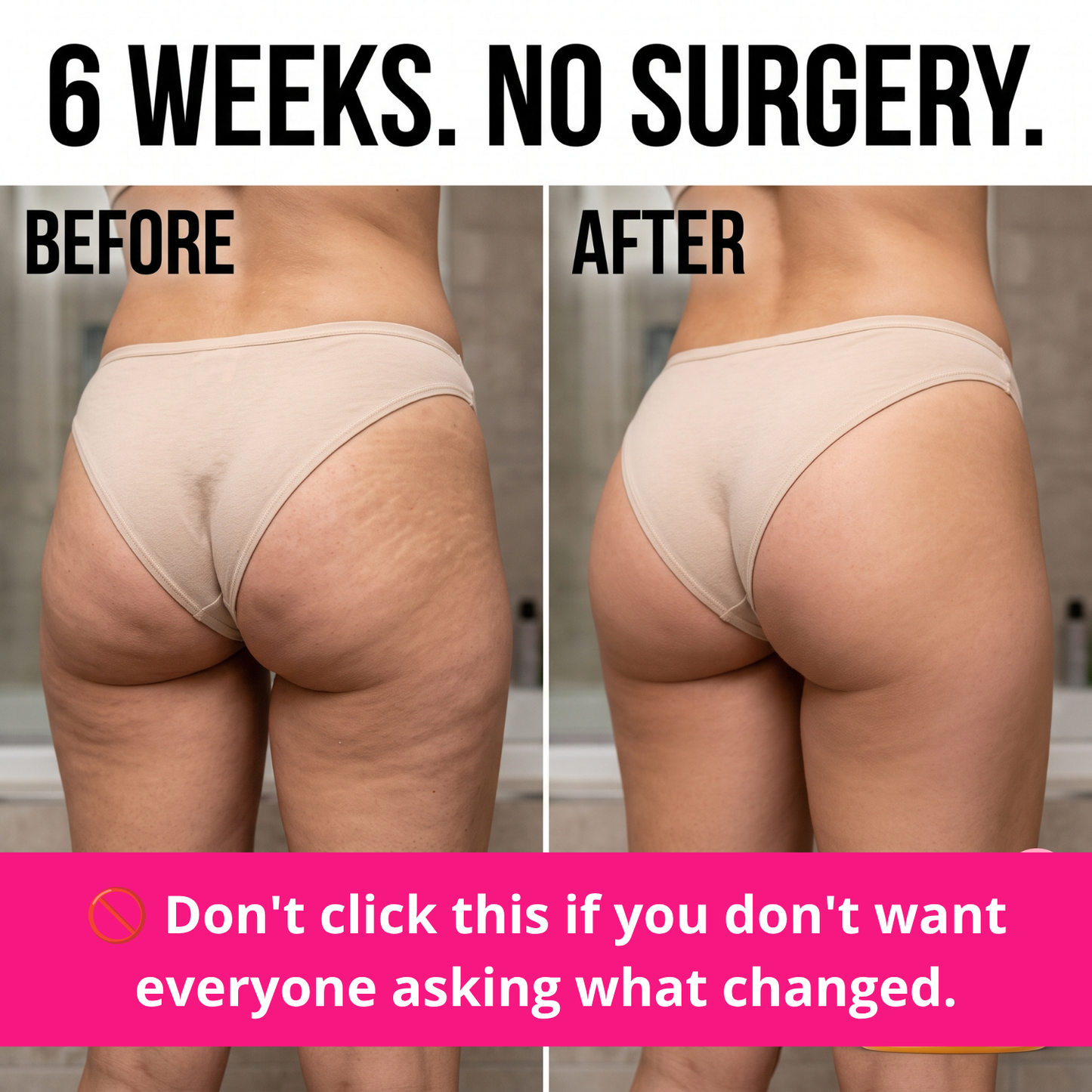 Still Angling Your Butt Out Of Every Photo Because Of Cellulite And Stretch Marks? A 60-Second Brazilian Ritual Is Fading Both — And Lifting The Whole Thing — In 6 Weeks, And American Dermatologists Are Stunned. No Needle. No Surgery. No Squats.