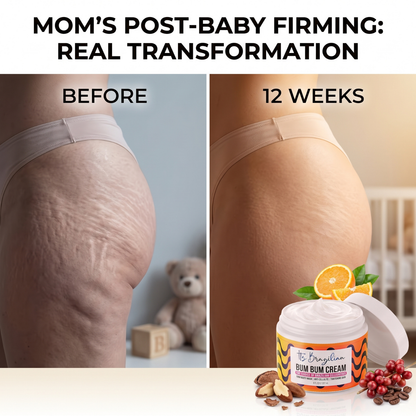 Still Angling Your Butt Out Of Every Photo Because Of Cellulite And Stretch Marks? A 60-Second Brazilian Ritual Is Fading Both — And Lifting The Whole Thing — In 6 Weeks, And American Dermatologists Are Stunned. No Needle. No Surgery. No Squats.