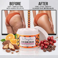 Still Angling Your Butt Out Of Every Photo Because Of Cellulite And Stretch Marks? A 60-Second Brazilian Ritual Is Fading Both — And Lifting The Whole Thing — In 6 Weeks, And American Dermatologists Are Stunned. No Needle. No Surgery. No Squats.