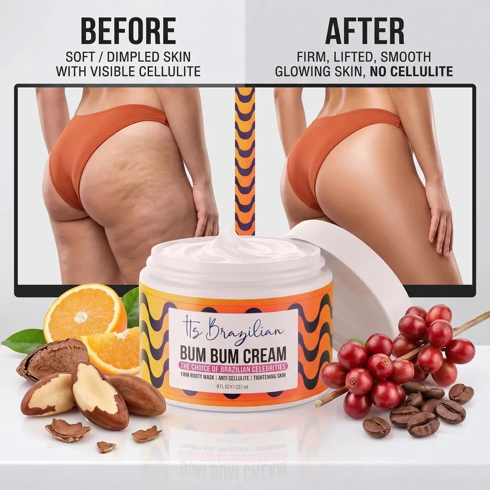 Still Angling Your Butt Out Of Every Photo Because Of Cellulite And Stretch Marks? A 60-Second Brazilian Ritual Is Fading Both — And Lifting The Whole Thing — In 6 Weeks, And American Dermatologists Are Stunned. No Needle. No Surgery. No Squats.